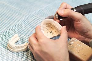 船橋での矯正歯科の受診希望について