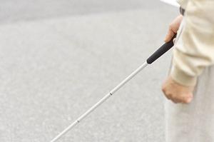 矯正を行う際は値段とデザインを考慮する