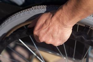 滋賀の美容皮膚科でケミカルピーリング