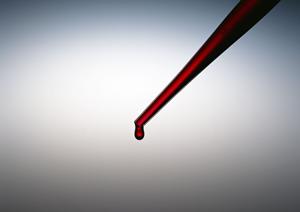 伊勢市で信頼できるインプラント治療：費用・期間・安心のクリニック完全ガイド